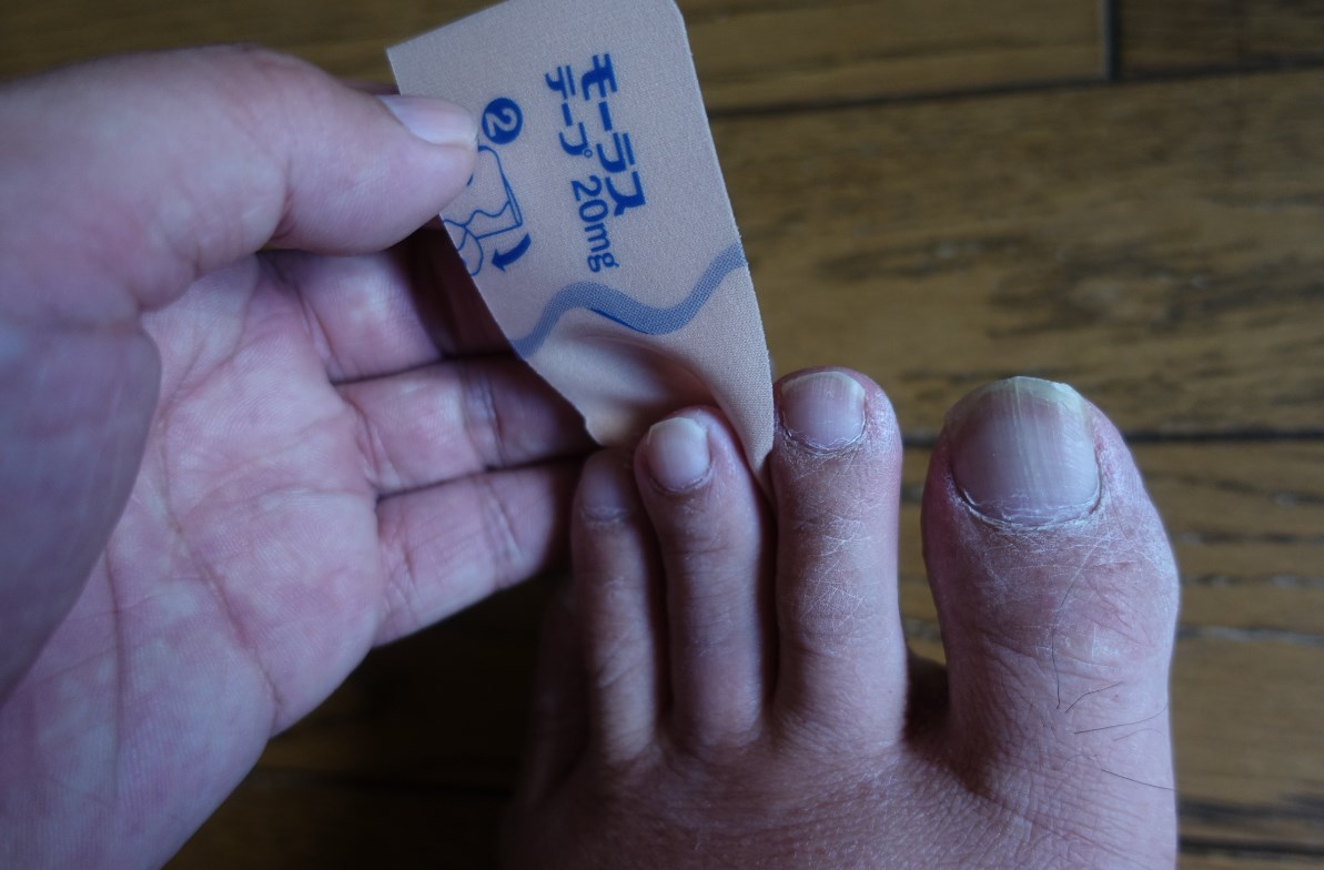 足 の 指 痛い 小指 プログラム ニュース